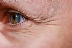 Picture for category Anti Aging