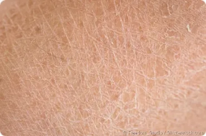 Picture for category Dry Skin