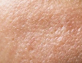 Picture for category Oily Skin